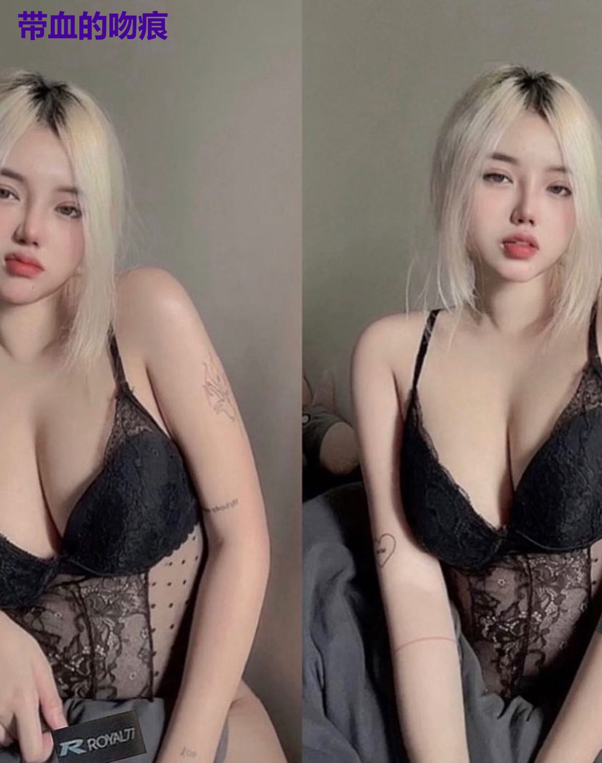 带血的吻痕