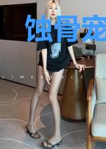 蚀骨宠婚:总裁男票又醋了